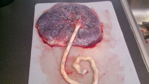 placenta mip
